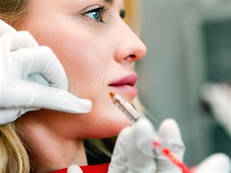 radiesse adalah|Radiesse: Cost, How It Works, Procedure, Targeted Areas, and .